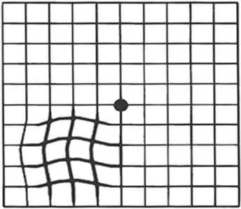 Grid with distortion and central black dot.
