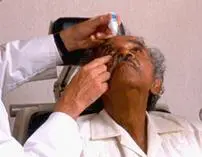 Doctor administering eye drops to a patient.